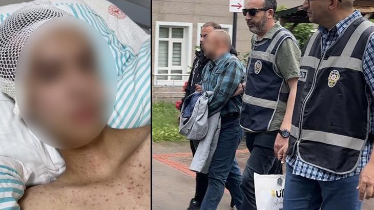 Komadan çıktı, her şeyi anlattı! Tacize direndiği iddiasıyla başından vurulan çocuk felç kaldı Haber gorseli